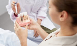 Dental Implants treatment for missing teeth