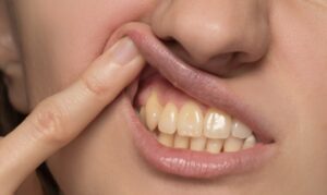 Developing Gum Disease - Timber Dental Care of Thornton